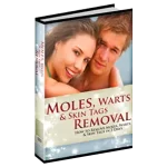 Mole, Warts, and Skin Tag Removal Review – [Updated 2025]